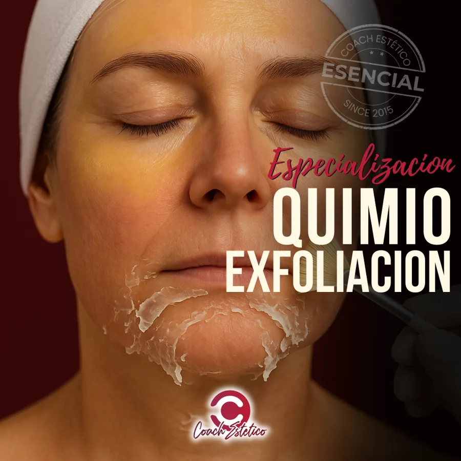 Quimioexfoliación PRO
