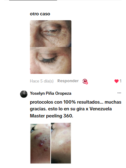 Testimonio original de Yoselyn Piña Oropeza