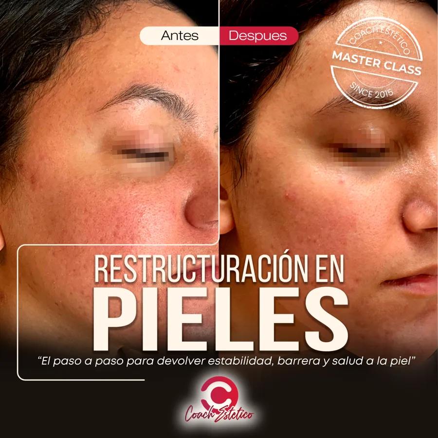 Reestructuración en Pieles